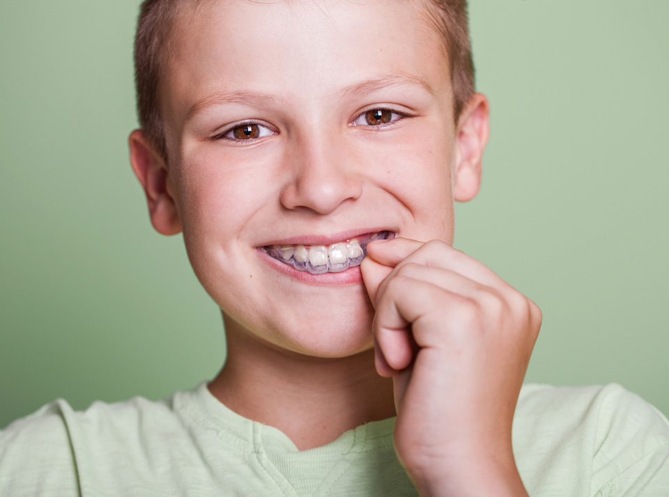 Invisalign for kids