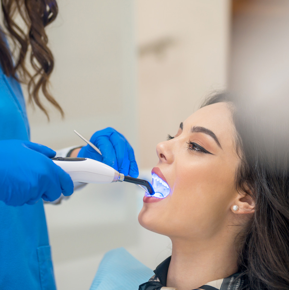 Benefits of Whitewash teeth whitening