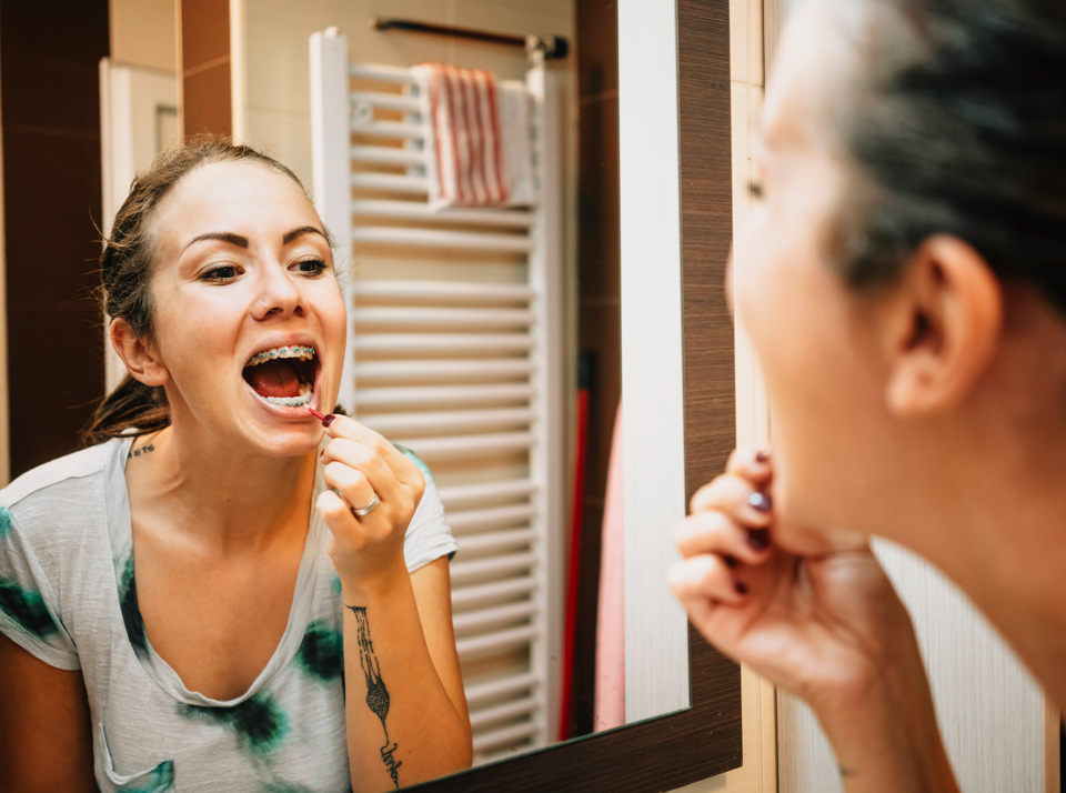 Looking after your braces